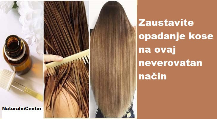ZAUSTAVITE OPADANJE KOSE NA OVAJ NEVEROVATAN NAČIN